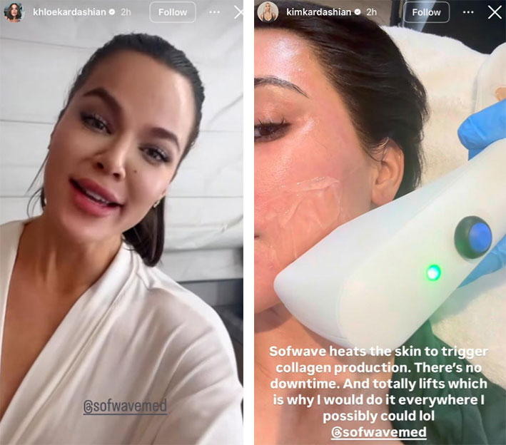 Kim and Khloe Kardashian having the Sofwave treatment