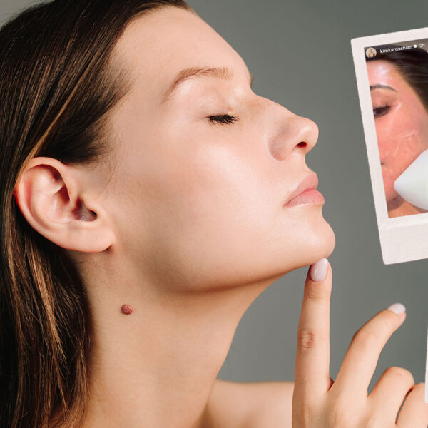 Woman side profile, with tight, firm skin and 2 inset images of Kim and hloe Kardashian having the Sofwave skin tightening treatment