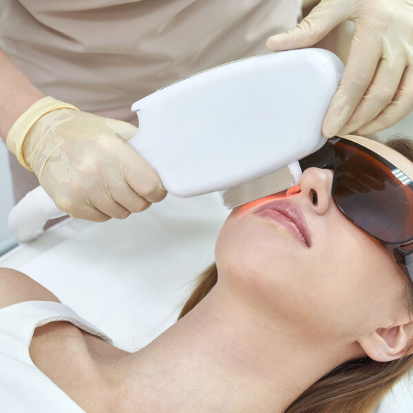 woman having laser treatment on face