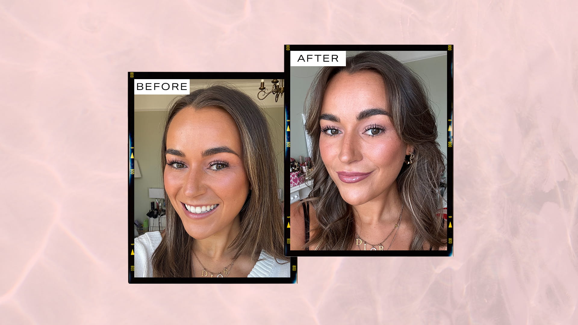 ‘Lip filler? Yes please – but don't make me look fake'